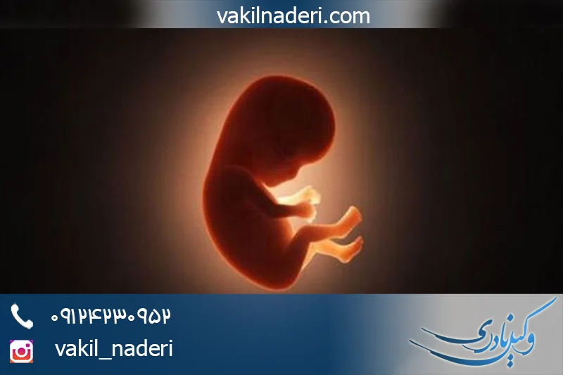 مشاوره تخصصی سقط جنین و آثار حقوقی آن با وکیل نادری